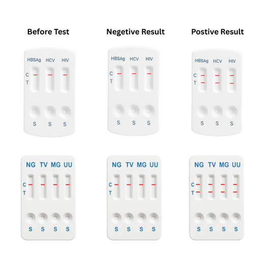 11 panel STD test cards showing before, negative, and positive results