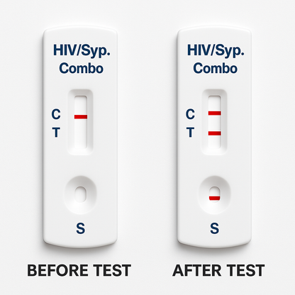 HIV and Syphilis Combo