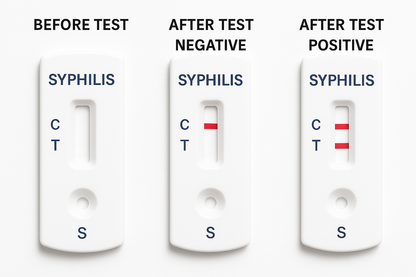 Syphilis Test Kit