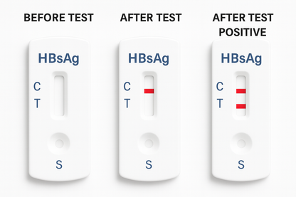 Hepatitis B Test Kit