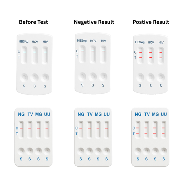 Std Kit Program 11 Panel STD Tests Kit – Gulf STD Test Kits