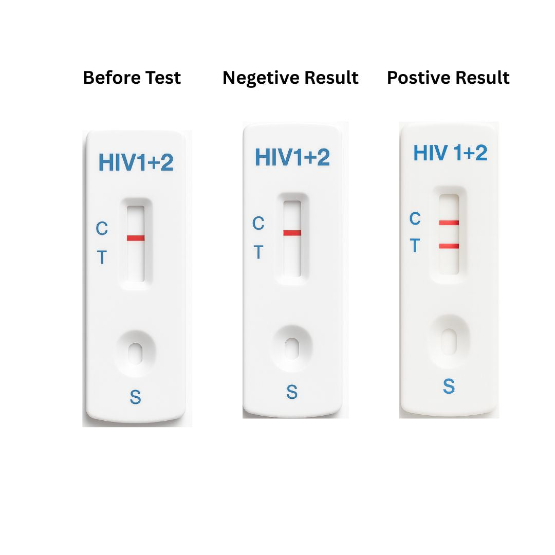 ELISA HIV Test Kit 4th Generation