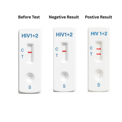 ELISA HIV Test Kit 4th Generation